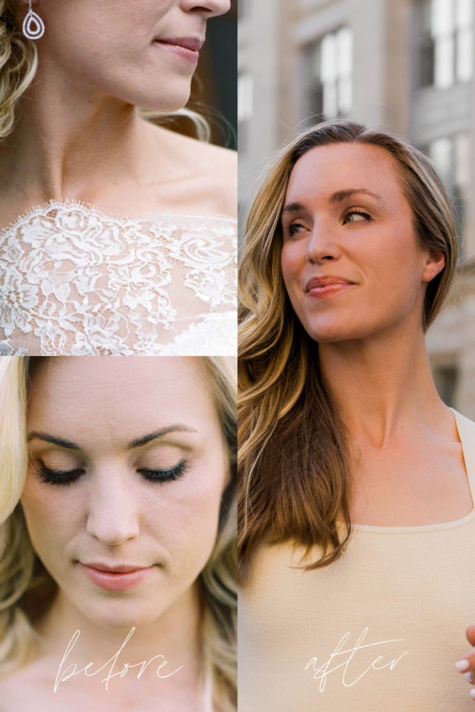 How to Get Clear Skin: 9 Things I Did to End My Struggle with Acne