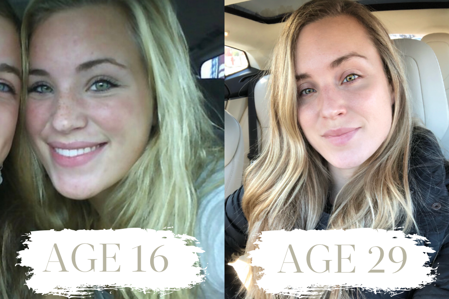 How to Have Better Skin 5 Years from Now Than You Do Today